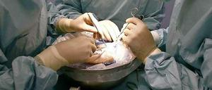 Viel zu wenig: Die Zahl der Organspenden in Deutschland geht weiter zurück.