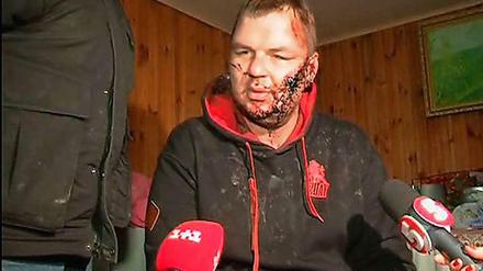Der ukrainische Aktivist Dmitro Bulatow wurde von seinen Entführern offenbar gefoltert. 
