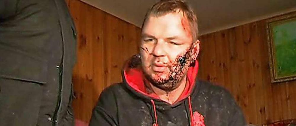 Der ukrainische Aktivist Dmitro Bulatow wurde von seinen Entführern offenbar gefoltert.