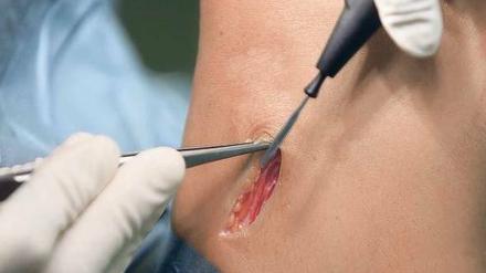Operation am Knie