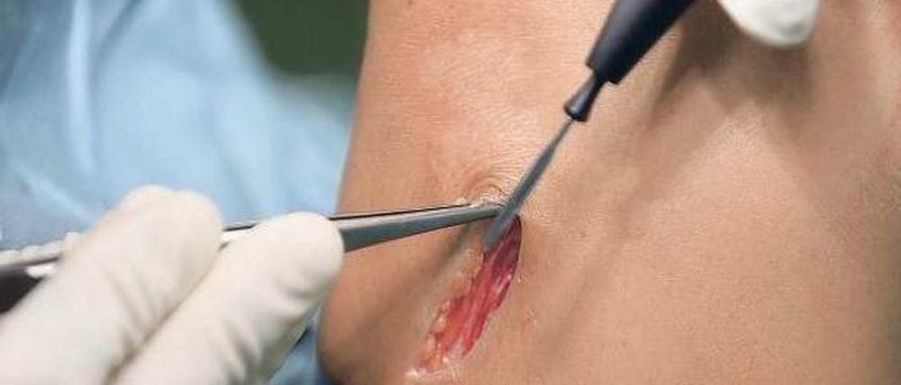 Operation am Knie