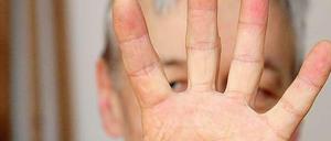 Wem gehört diese Hand? 