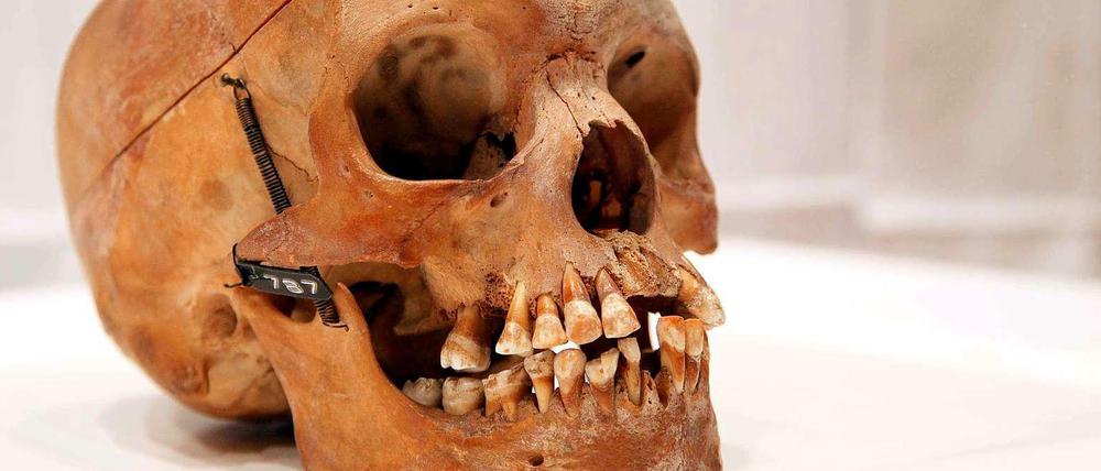 Ein Totenschädel aus der Sammlung der Charité
