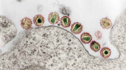 HIV unter dem Elektronenmikroskop