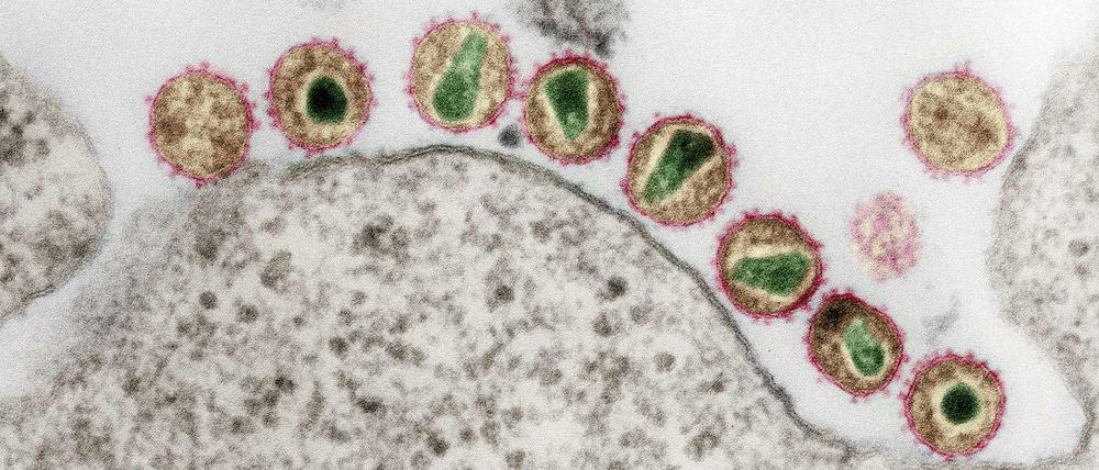 HIV unter dem Elektronenmikroskop