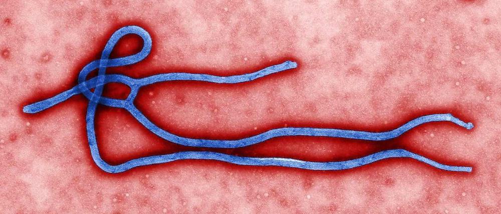 Das Bild zeigt ein Ebola-Virus.