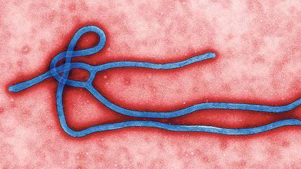 Ebola