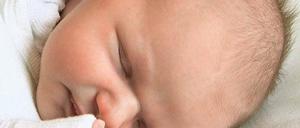 Kopfsache. Liegen Babys stets auf der gleichen Seite, drohen Verformungen.