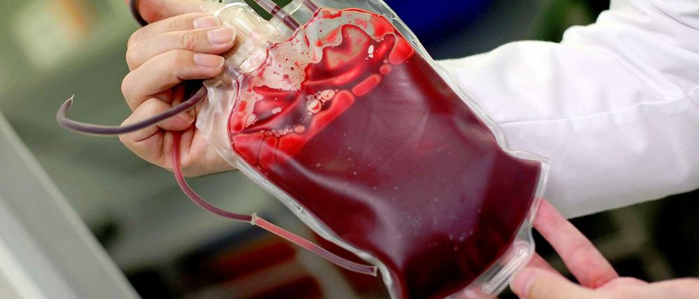 Blutkonserve. In Deutschland werden jeden Tag etwa 15000 Blutspenden benötigt.