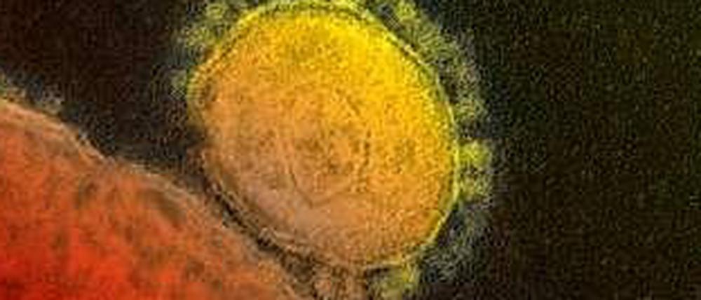 Das neue Coronavirus Mers