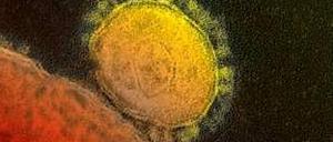 Das neue Coronavirus Mers