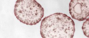 Masernvirus
