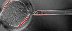 Zum ersten Mal haben Forscher Stammzellen aus den Hautzellen von Erwachsenen geklont.