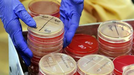 Gefährlich. Ein Patient aus Griechenland trug den multiresistenten Keim KPC ins Uniklinikum Leipzig - und führte zu einem Ausbruch, der zwei Jahre dauerte.