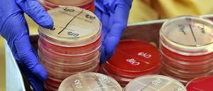 Gefährlich. Ein Patient aus Griechenland trug den multiresistenten Keim KPC ins Uniklinikum Leipzig - und führte zu einem Ausbruch, der zwei Jahre dauerte.