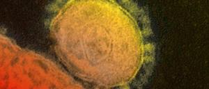 Das Mers-Virus unter dem Mikroskop.