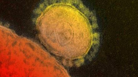 Der Erreger. Eine elektronenmikroskopische Aufnahme des Mersvirus. 