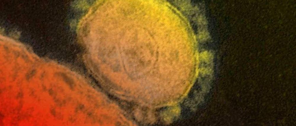 Der Erreger. Eine elektronenmikroskopische Aufnahme des Mersvirus.