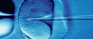 Künstliche Befruchtung. Forscher und Ethiker diskutieren, wie stark eine Eizelle verändert werden darf, aus der später ein Mensch heranwachsen soll.