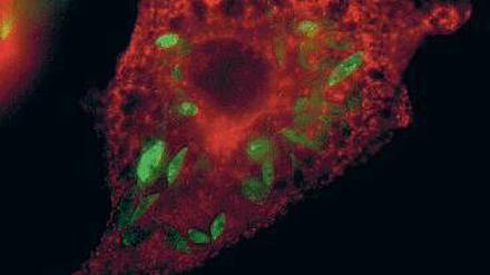 Versteckspiel. Leishmaniosen (grün) sind Parasiten, die sich in den Fresszellen (rot) des Immunsystems vermehren.