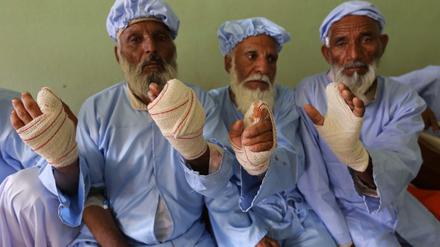 Wahl und Gewalt: Weil sie zur Wahl gegangen waren, schnitten Taliban diesen Männern die mit Tinte gekennzeichneten Finger ab.