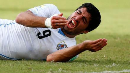 Luis Suarez nach seiner mutmaßlichen Beißattacke.