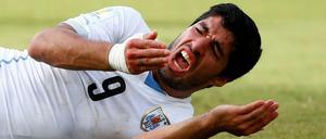 Luis Suarez nach seiner mutmaßlichen Beißattacke.