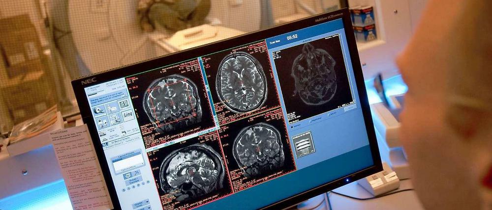 Kompliziert. Einzelne Einsichten in das Gehirn sind längst möglich - eine Simulation im Computer halten jedoch viele für Science Fiction.