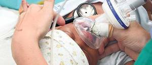 Kleine Kinder bekommen bei einer Operation heute eine wirksame Schmerzbehandlung.