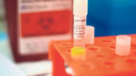 Blutproben erkrankter Ebola-Patienten. 