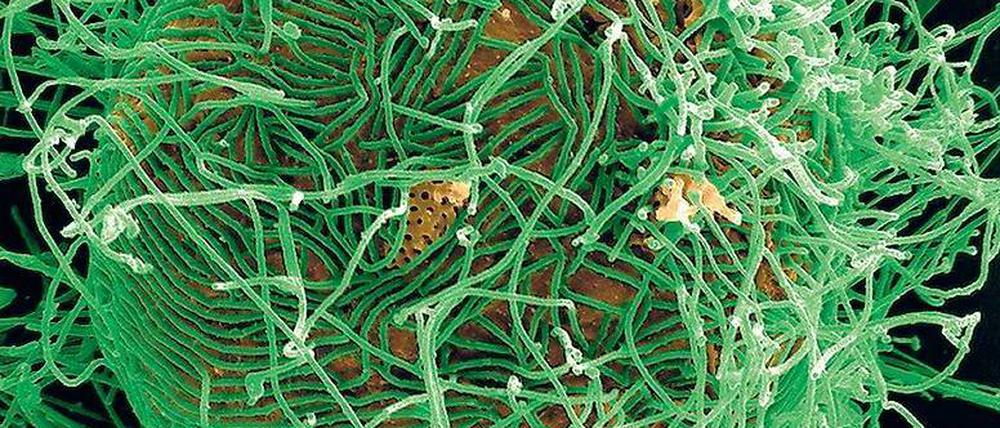 Virenfabrik. Ist eine Zelle (orange koloriert) mit Ebola infiziert, produziert sie am laufenden Band Kopien des fadenförmigen Virus (grün). Eine Zelle nach der nächsten wird so zur Virenfabrik.