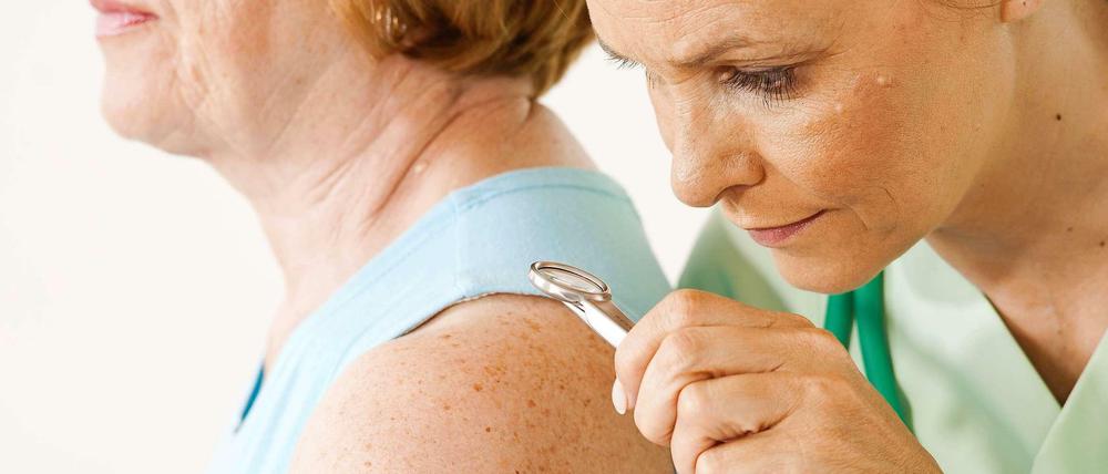 Krankenkassen bezahlen die Hautkrebs-Früherkennungsuntersuchung.