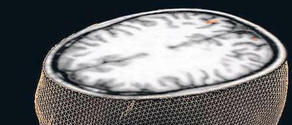 Das Gehirn ist flexibler als gedacht. Bei Verletzungen können Gliazellen als Stammzellen fungieren und neue Nervenzellen hervorbringen. 