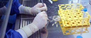 Ein Labormitarbeiter arbeitet mit einem Präparat.