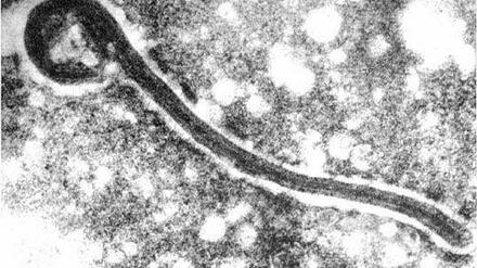 Wie Ebola gehört auch das Marburg-Virus zu den fadenförmigen Filoviren. 