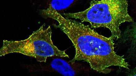 Erfolg geduldigen Forschens: Bucher Wissenschaftler entdeckten, dass das Protein LRRC8A (rot gefärbt) zusammen mit mindestens einem anderen der fünf Familienmitglieder (hier: LRRC8E, grün gefärbt, als Komplex vorliegend in Gelb) eine essentielle Komponente des volumenregulierten Anionenkanals (VRAC) in der Plasmamembran der Zelle bilden.