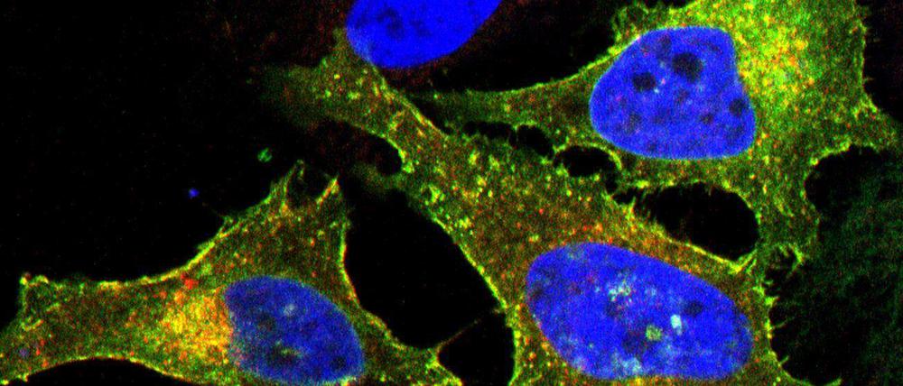 Erfolg geduldigen Forschens: Bucher Wissenschaftler entdeckten, dass das Protein LRRC8A (rot gefärbt) zusammen mit mindestens einem anderen der fünf Familienmitglieder (hier: LRRC8E, grün gefärbt, als Komplex vorliegend in Gelb) eine essentielle Komponente des volumenregulierten Anionenkanals (VRAC) in der Plasmamembran der Zelle bilden.