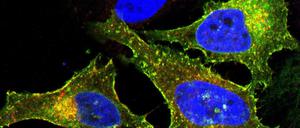 Erfolg geduldigen Forschens: Bucher Wissenschaftler entdeckten, dass das Protein LRRC8A (rot gefärbt) zusammen mit mindestens einem anderen der fünf Familienmitglieder (hier: LRRC8E, grün gefärbt, als Komplex vorliegend in Gelb) eine essentielle Komponente des volumenregulierten Anionenkanals (VRAC) in der Plasmamembran der Zelle bilden.