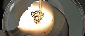 Apple und Facebook finanzieren ihren Mitarbeiterinnen das "Social Freezing" - das Einfrieren von Eizellen.