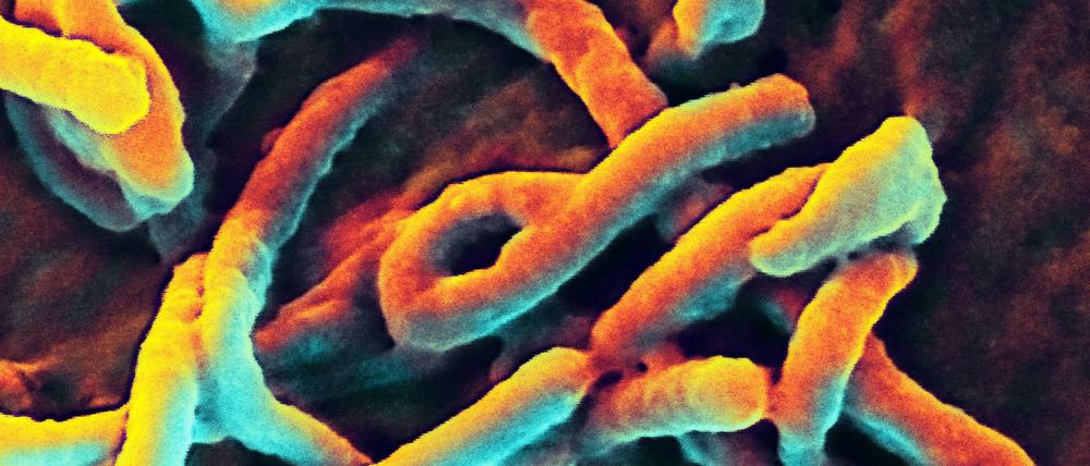 Ebolaviren unter dem Elektronenmikroskop.