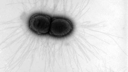 Kaum noch kontrollierbar. Klebsiella pneumoniae hat bereits Varianten entwickelt, gegen die gar kein oder nur ein altes Reserveantibiotikum hilft.