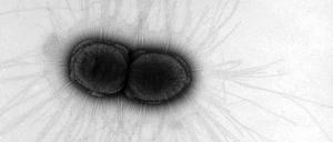 Kaum noch kontrollierbar. Klebsiella pneumoniae hat bereits Varianten entwickelt, gegen die gar kein oder nur ein altes Reserveantibiotikum hilft.