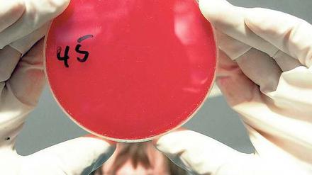 Unter Aufsicht. Wissenschaftler entwickeln narrensichere Mikroorganismen für die Biotechnik. 
