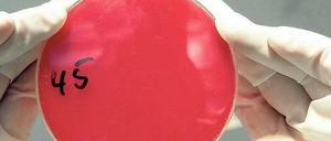 Unter Aufsicht. Wissenschaftler entwickeln narrensichere Mikroorganismen für die Biotechnik.