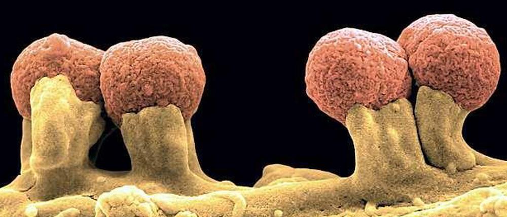 Viele Bakterien können dem Menschen schaden. Gefährlich wird es, wenn sie nicht mehr auf Antibiotika reagieren.