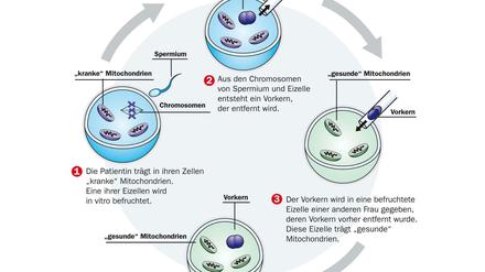 So funktioniert die nVorkern-Transfer-Methode.