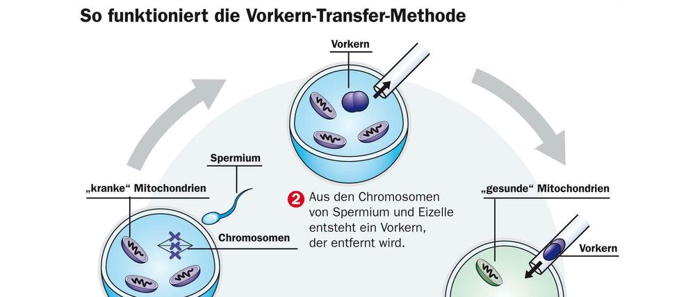 So funktioniert die nVorkern-Transfer-Methode.