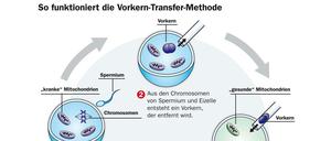 So funktioniert die nVorkern-Transfer-Methode.