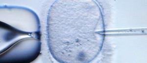 Experiment mit Folgen. Für die neue Gentherapie wird einer befruchteten Eizelle der Vorkern entnommen und in die Eizell-Hülle einer Spenderin eingesetzt. So soll das Kind alle relevanten Gene von Mutter und Vater bekommen und trotzdem gesund bleiben.