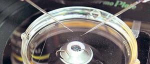Hilfe aus dem Labor. Dem Entwurf zufolge sollen Embryos mit dem Erbgut von drei Elternteilen erlaubt sein. 